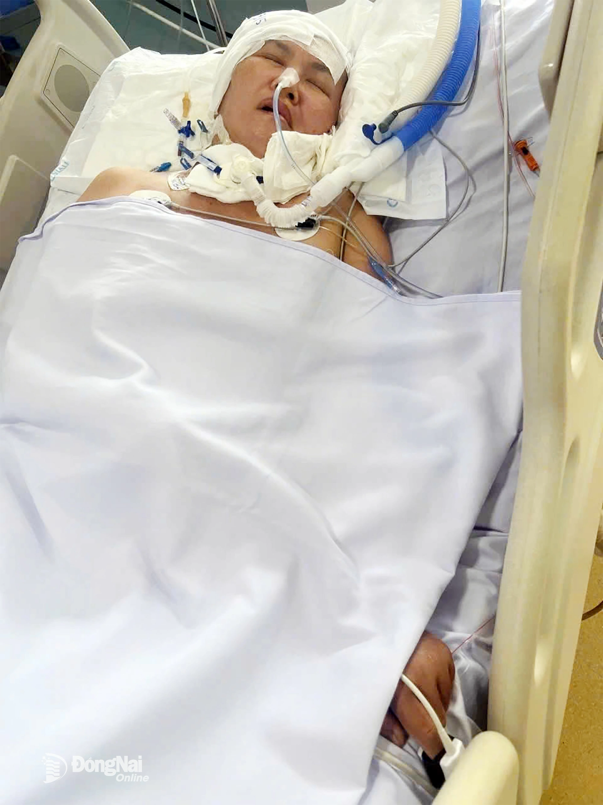 Bà Bùi Thị Hồng, mẹ của anh Đạt, vẫn nằm bất động sau vụ tai nạn, sống nhờ ống thở và sự chăm sóc của con trai. Ảnh: Thu Hiền